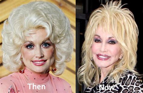 dolly parton real boobs|Dolly Parton Plastic Surgery: 7 Times the Star Talked About Her。